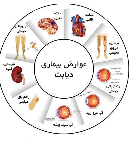 ارائه خدمات ویژه در کلینیک تخصصی دیابت در شهرستان داراب